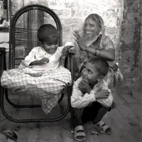 Cancer de la peau chez un enfant, Inde